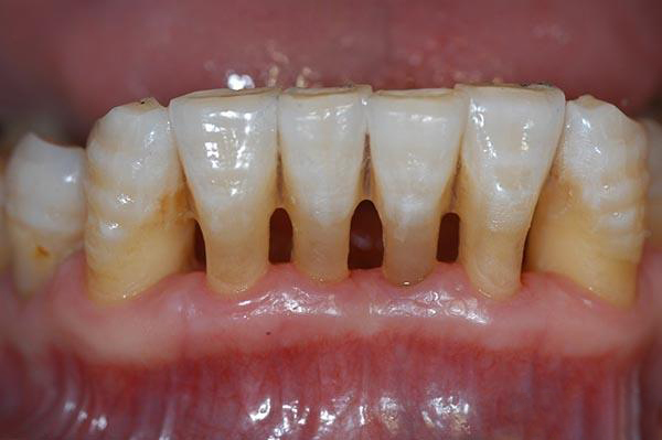 昆明最新24小时牙医在线咨询方法分析(最方便真实的昆明有没有24小时牙医方法)